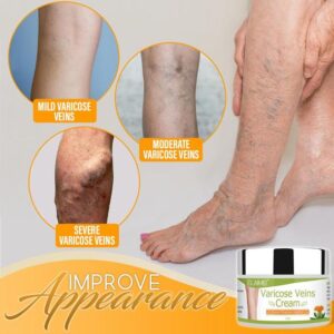 Organic Healing Cream for Varicose Vein