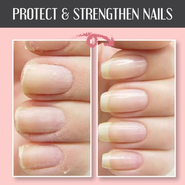 Nail Repair Protection Gel💅🌹BUY 2 GET 1 FREE🌹BUY 3 GET 2 FREE