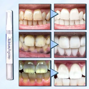 🔥BUY 1 GET 1 FREE🔥 SwipeBright Instant Whitening Oral Pen