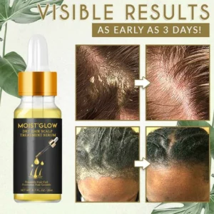 Moist'Glow Dry Scalp Treatment Serum