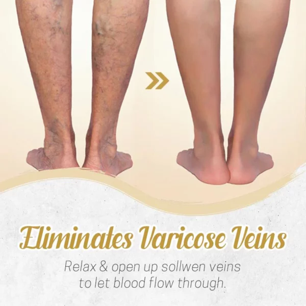 Herbal Detox Patch for Varicose Veins