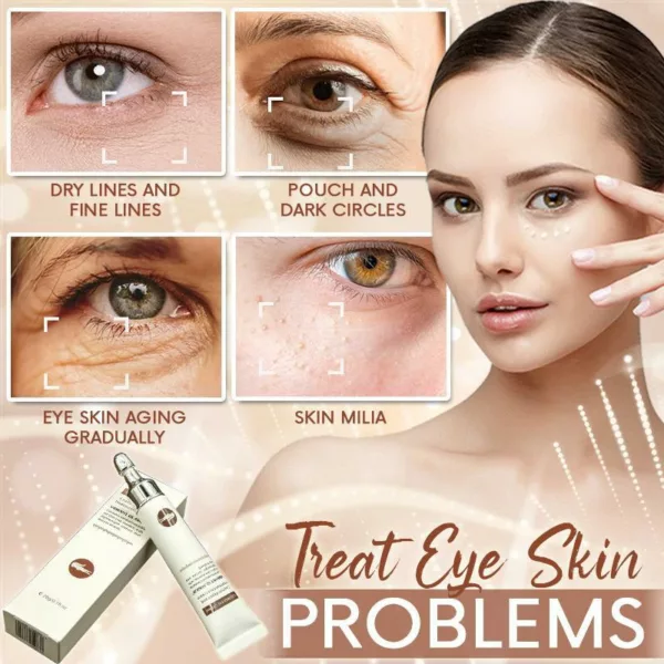 Anti FatGranule Eye Cream