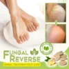 Fungal Reverse Herbal Treatment Foot Soak