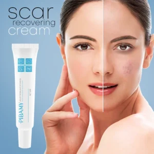 Scar Recover Cream