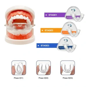 SmilePerfect Kit