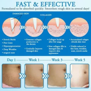 Striae Off™ Anti-Stretch Mark Cream