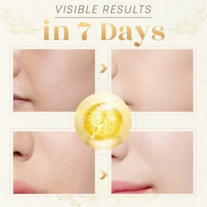 Line-Rescue Golden Collagen Peptide Kit