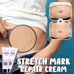 Stretch Mark Repair Cream