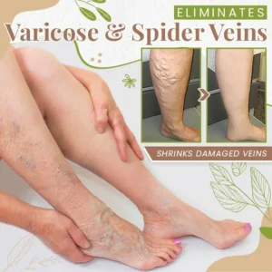 HerbsCure™ Anti-Varicose Veins Foot Soak