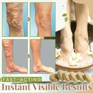 HerbsCure™ Anti-Varicose Veins Foot Soak