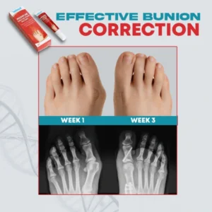 Bunion Relief Ointment Cream