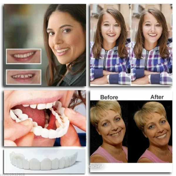 (🎄Christmas sale - 🔥30% off) Adjustable dentures😁 recommended by German doctor dentist👨‍⚕.