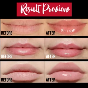 💋5 Mins Extreme Lip Plumper