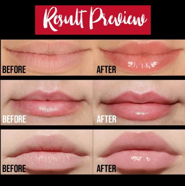 💋5 Mins Extreme Lip Plumper