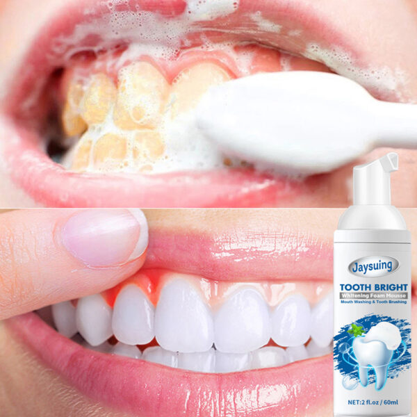 🔥BUY 1 GET 1 FREE🔥2022 Jaysuing™ TEETH WHITENING MOUSSE