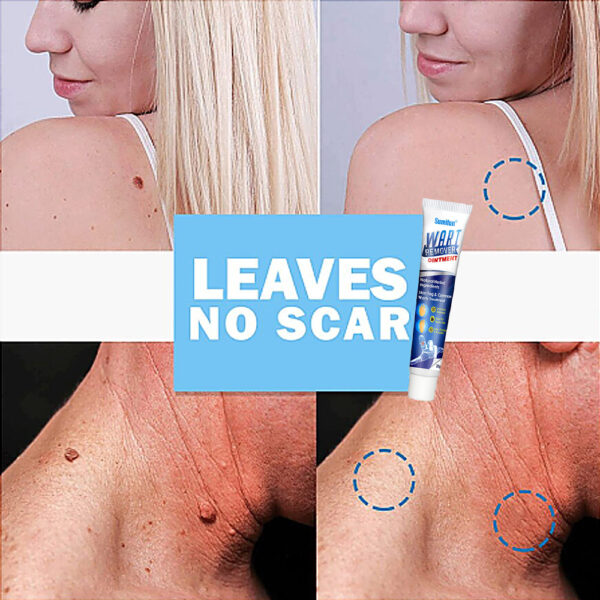 🔥BUY 1 GET 1 FREE🔥Instant Blemish Removal Gel