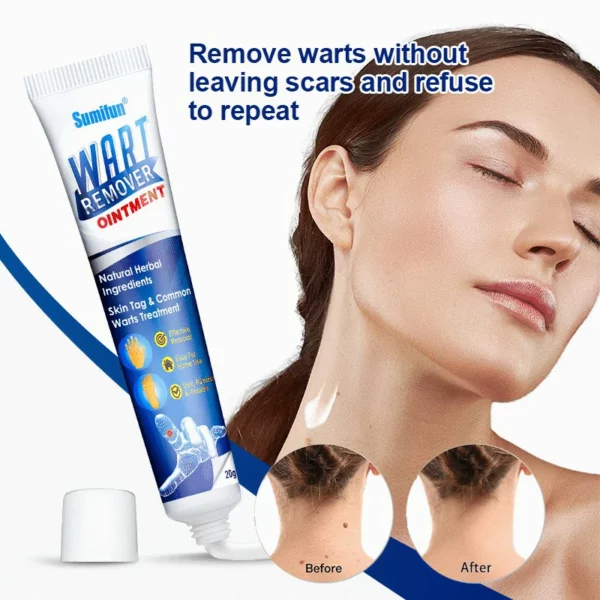 🔥BUY 1 GET 1 FREE🔥Instant Blemish Removal Gel - Image 4