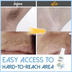 🔥Buy 1 Get 1 Free🔥SEMI-PERMANENT HAIR REMOVAL SPRAY