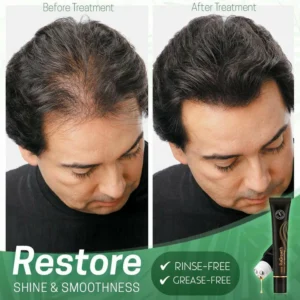 Regrowth™ Organic Hair Serum Roller