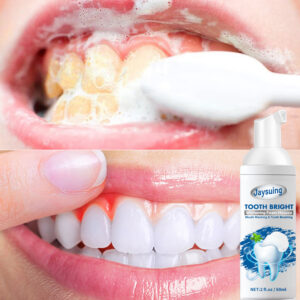 BUY 1 GET 1 FREE-JAYSUING ™ TEETH WHITENING MOUSSE