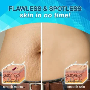 Dr. Removal™ Stretch Mark Firming Cream