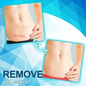 Dr. Removal™ Stretch Mark Firming Cream