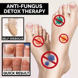 Anti-Fungal Peeling Foot Soak