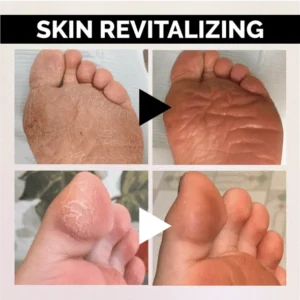 Anti-Fungal Peeling Foot Soak