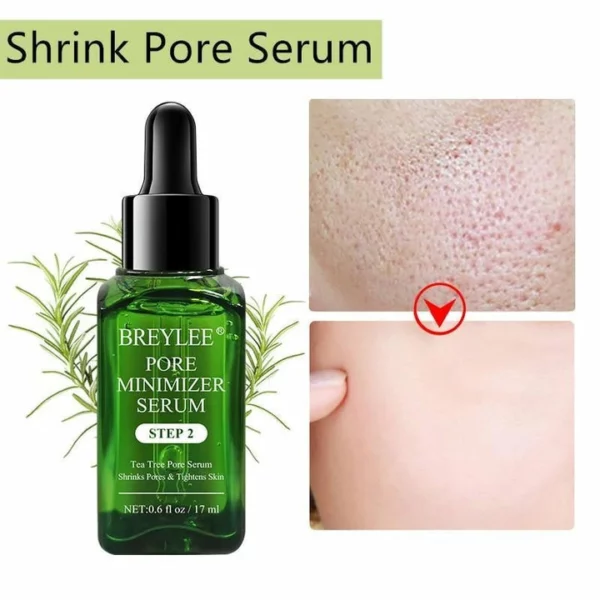 Blackhead Remover Serum