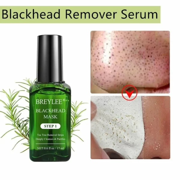 Blackhead Remover Serum