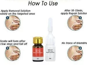 Mole & Skin Tag Removal Solution