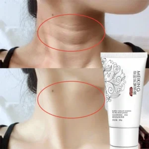 Anti Wrinkle Neck Cream