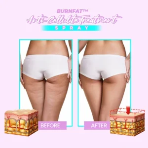 BurnFat™ Body Slimming Spray