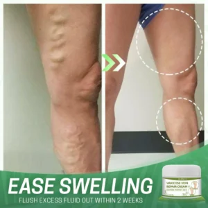 BeauSkin™ Spider Veins Repair Cream