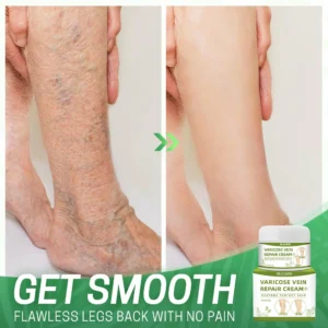 BeauSkin™ Spider Veins Repair Cream