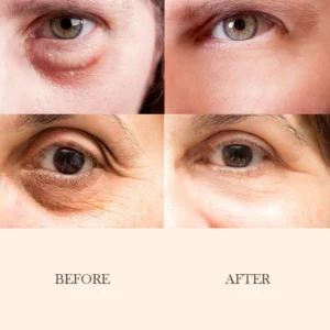 Intensive Eye Firming Cream