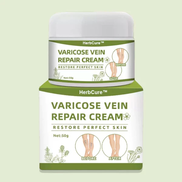 Varicose Veins Healing Cream