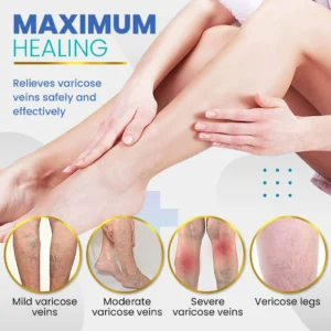 BeauSkin Spider Veins Repair Cream