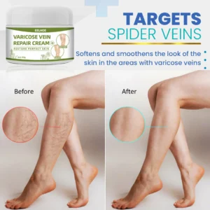 BeauSkin Spider Veins Repair Cream