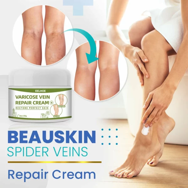 BeauSkin Spider Veins Repair Cream