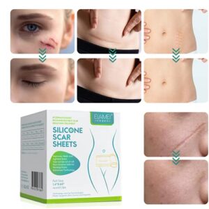 ELAIMEI™ Medical Soft Silicone Gel Tape for Scar Removal (1.6” x 60”）