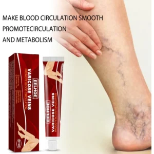 Varicose Veins Relief Cream