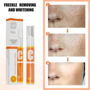 Vitamin C Freckle Dark Spot Removal Cream