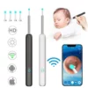 Clean Earwax - Wi -Fi Visible Wax Elimination Spoon