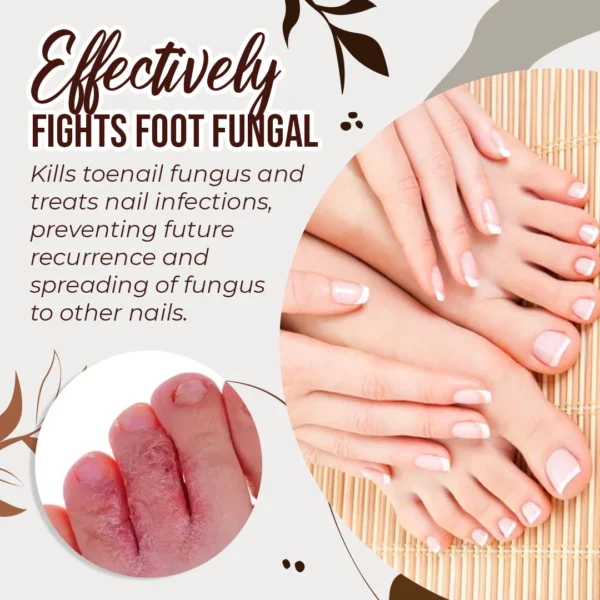 Premium Anti-Fungal Treatment Spray - Image 3