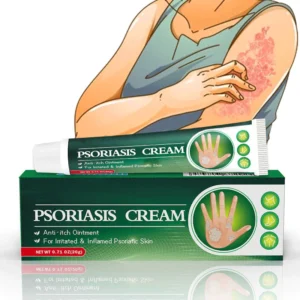 SHIRLN™ Psoriasis Cream