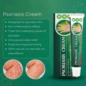 SHIRLN™ Psoriasis Cream