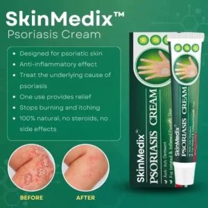 SKINMEDIX™PSORIASIS CREAM