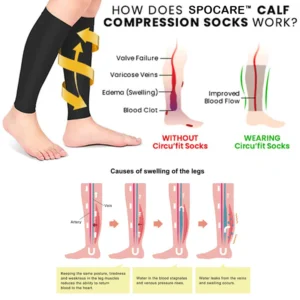 SPOCARE™ Thermally Cycling Self-Shaping Compression Socks