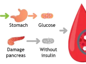 ANLOMARE Blood Sugar Reducing Body Detox Footbed